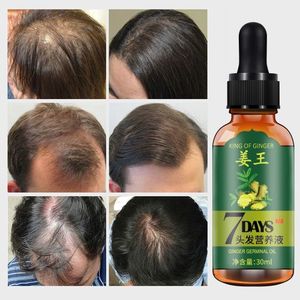 Aichun 7 Days Hair Tonic, Growth Oil, Ginger ,anti-hair Loss
