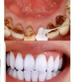 Vaseina Teeth Whitening Essence Tooth Whitener Remove Stains