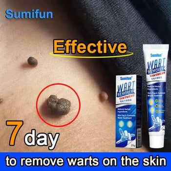Say Goodbye to Warts Forever with Herbal Ointment!