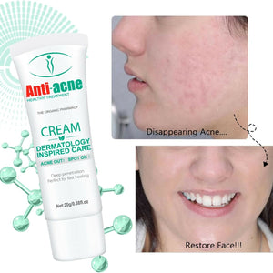 Aichun Beauty Anti-Acne Cleaning Cream
