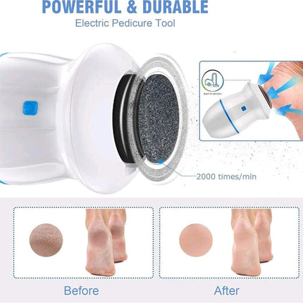 Rechargeable Find Back Callus Remover With Built-In Vacuum Foot Grinder Machine Hard Crack Cleaning