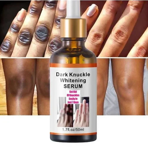 Dark Spots Corrector Serum – Brightening Treatment for Elbows, Knuckles & Knees