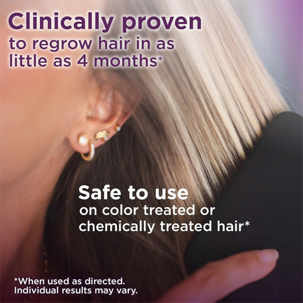 Minoxidil 2% Hair Regrowth Treatment For Women 360ml