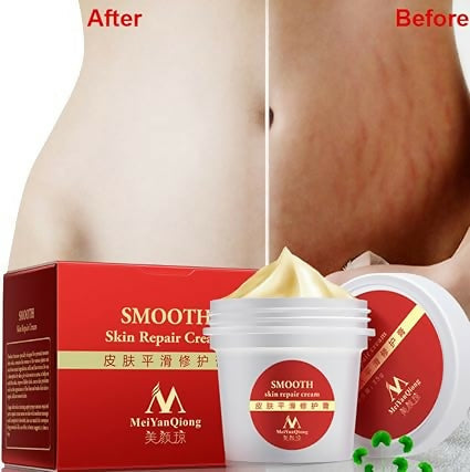 Meiyanqiong Skin Repair Cream