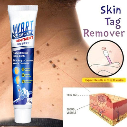 Herbal Warts Remover Ointment – Fast-Acting Mole & Wart Removal Cream for Face & Body