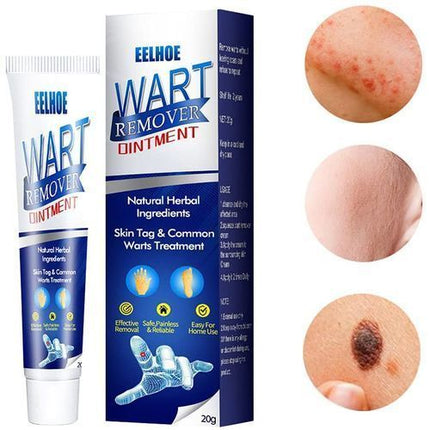 Herbal Warts Remover Ointment – Fast-Acting Mole & Wart Removal Cream for Face & Body