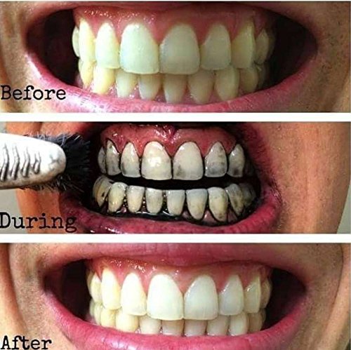 Dr Rashel Charcoal Whitening Toothpaste – Deep Clean, Fresh Breath & Natural Teeth Whitening