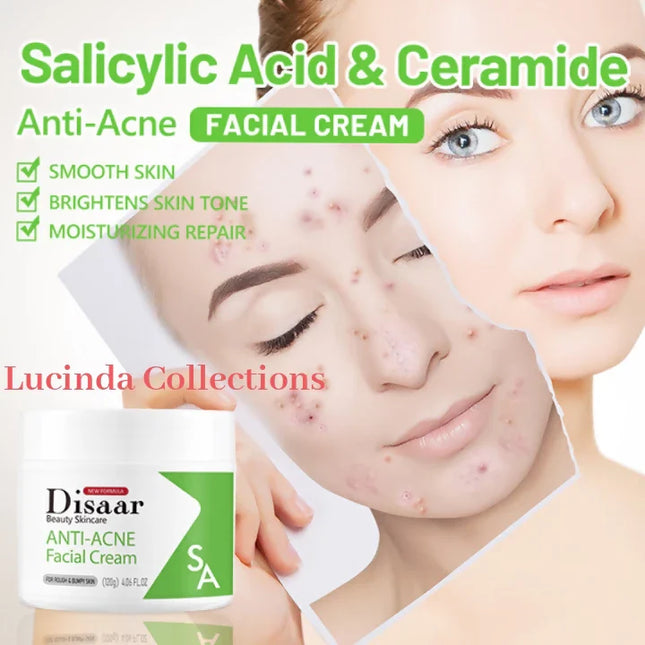 Salicylic Acid Anti-acne Facial Cream ,Ceramide Whitening Repair - Disaar