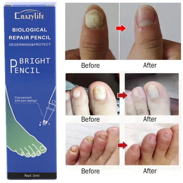 CrazyLife Biological Repair Pencil