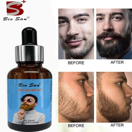Concentrated Deard Growth Oil Nourishing And Conditioning Beard Care Products