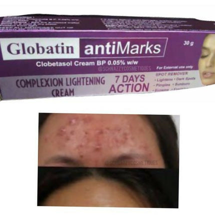 Gandour Globatin Cream