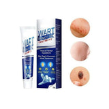 Warts Remover Ointment – Fast & Natural Treatment for Warts, Moles, Skin Tags & Corns
