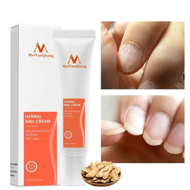 Meiyanqiong Herbal Nail Repairing Cream Antifungal Repair