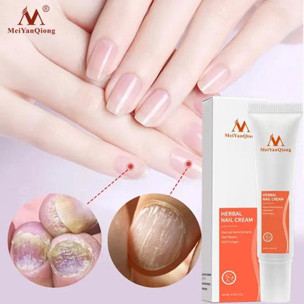 Meiyanqiong Herbal Nail Repairing Cream Antifungal Repair