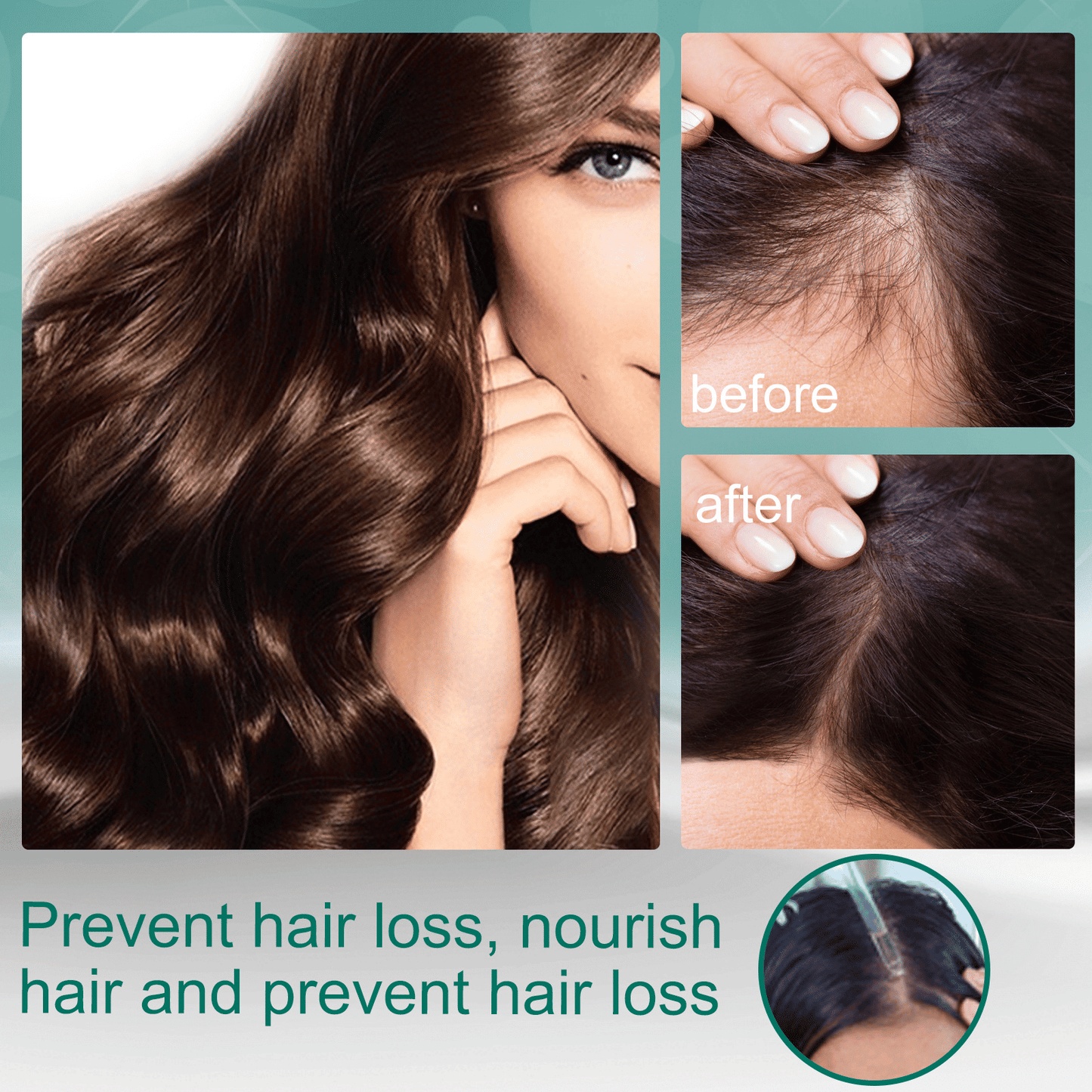 Advanced Ginger Hair Growth Oil Serum: Prevents Loss, Strengthens, Nourishes, Revitalizes Scalp