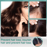 Advanced Ginger Hair Growth Oil Serum: Prevents Loss, Strengthens, Nourishes, Revitalizes Scalp