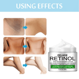 Body Whitening Cream for Underarm Knee Buttocks 50ml