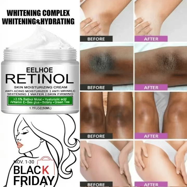 Body Whitening Cream for Underarm Knee Buttocks 50ml