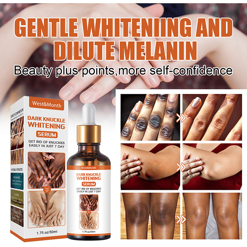 https://image.kilimall.com/kenya/shop/store/goods/8607/2023/05/168354111865678529247b715451796b1e789a7bd6805.jpg