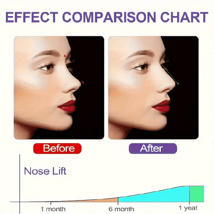 https://img.kilimall.com/c/obs/seller/100001976/goods_image/251129101831_bfdb4aef9665b8079cbf2bcc80625954.png