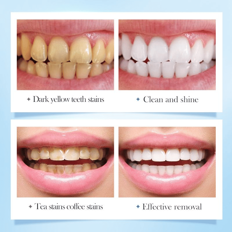 https://img.kilimall.com/c/obs/seller/100002513/goods_image/250524111710_237432c6198a67c5cc50e72c726d1195.jpg