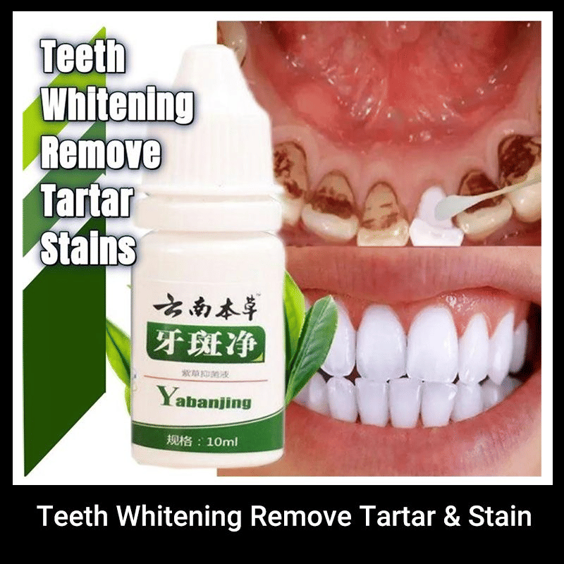 https://img.kilimall.com/c/obs/seller/100006146/goods_image/251019102830_f4260081c21e8641e5f8482775b04016.jpg