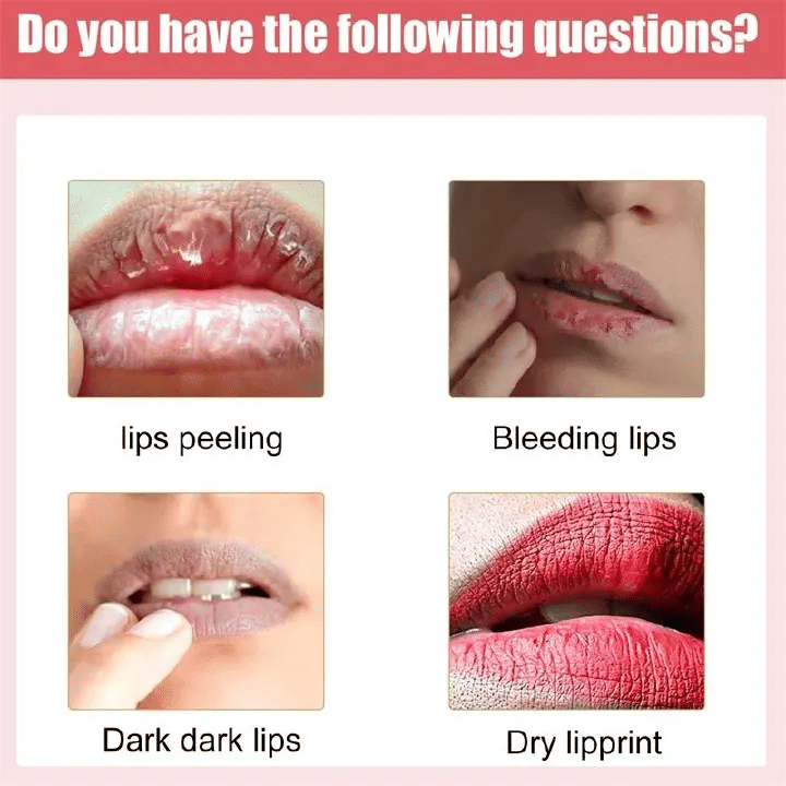 https://img.kilimall.com/c/obs/seller/100008492/goods_image/251127095737_4aac4bc7287d31d25aecba849cf9e9e7.png