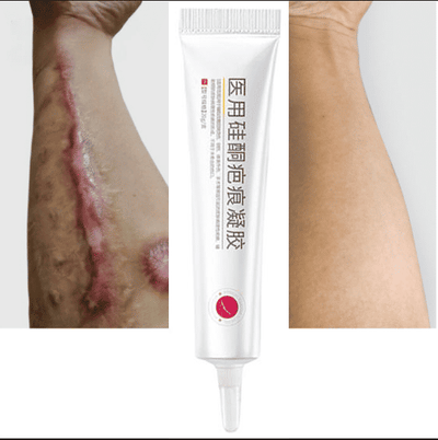 Medical Silicone Scar Gel Cream for Burn C-Section Removal 20g