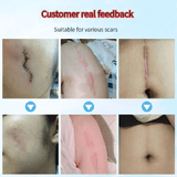 https://img.kilimall.com/c/obs/seller/100009921/goods_image/260122124757_65ef0c13b25b8e5f94454a7a98f802c3.png