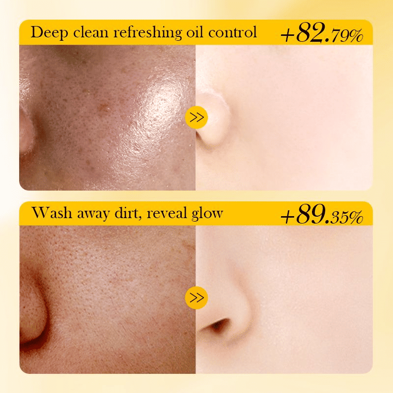 https://img.kilimall.com/c/obs/seller/100011329/goods_image/260126085152_dd8789d77308d24077e570f9a476d7db.jpg