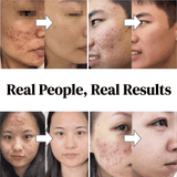 https://img.kilimall.com/c/obs/seller/100011329/goods_image/260407125937_0d3b6734168d5b2b9d373d04967d9050.jpg