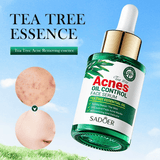 https://img.kilimall.com/c/obs/seller/5353/goods_image/241106175750_38bc7b068900e7d216a827cd18499e74.jpg