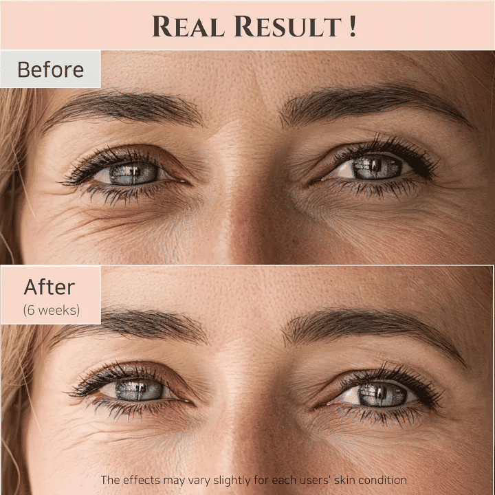 Beauty of Joseon Revive Eye Serum Ginseng Retinal Niacinamide Anti-Wrinkle Dark Circles Puffiness 30ml