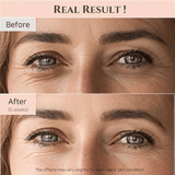 Beauty of Joseon Revive Eye Serum Ginseng Retinal Niacinamide Anti-Wrinkle Dark Circles Puffiness 30ml