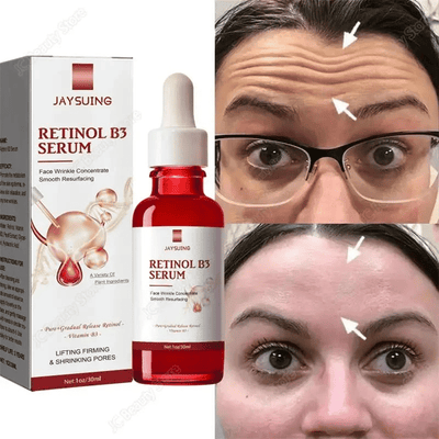 Jaysuing Retinol B3 Facial Serum Anti-Aging Wrinkle Remover 30ml