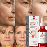 https://img.kilimall.com/c/obs/seller/8607/goods_image/240922095930_042870551f692ab33665da552f3b1a8a.jpg