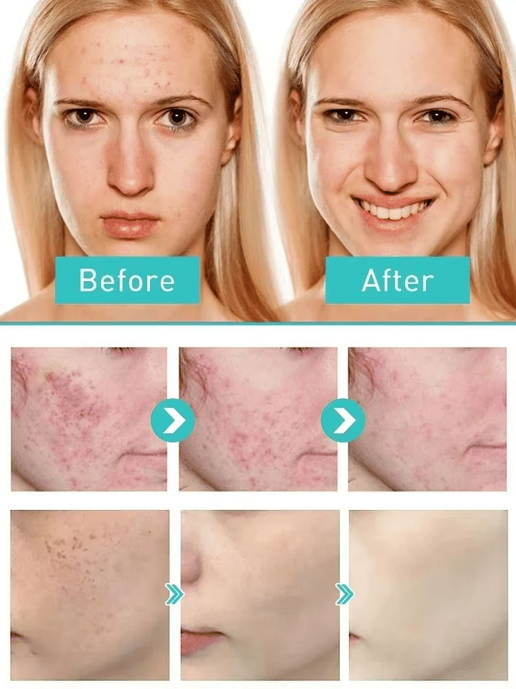 https://img.kilimall.com/c/obs/seller/8607/goods_image/250329093121_25d364918b3a0b6bedb0092121633c8f.jpg