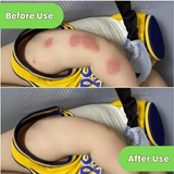 Kormesic Mosquito Repellent Spray 100ml