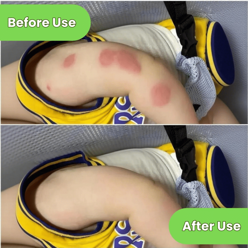 Kormesic Mosquito Repellent Spray 100ml
