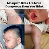Kormesic Mosquito Repellent Spray 100ml