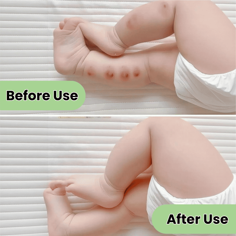 Kormesic Mosquito Repellent Spray 100ml