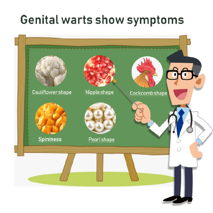 Genital Warts Remover Antibacterial Treatment Cream 20g