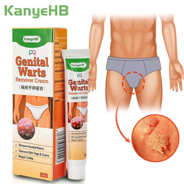 Genital Warts Remover Antibacterial Treatment Cream 20g