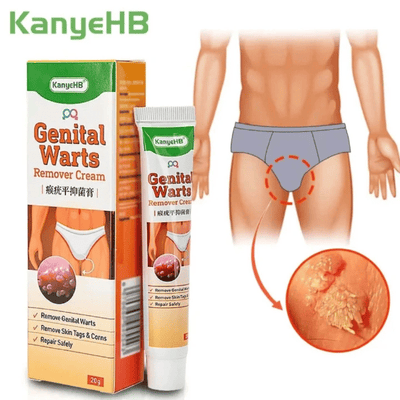 Genital Warts Remover Antibacterial Treatment Cream 20g