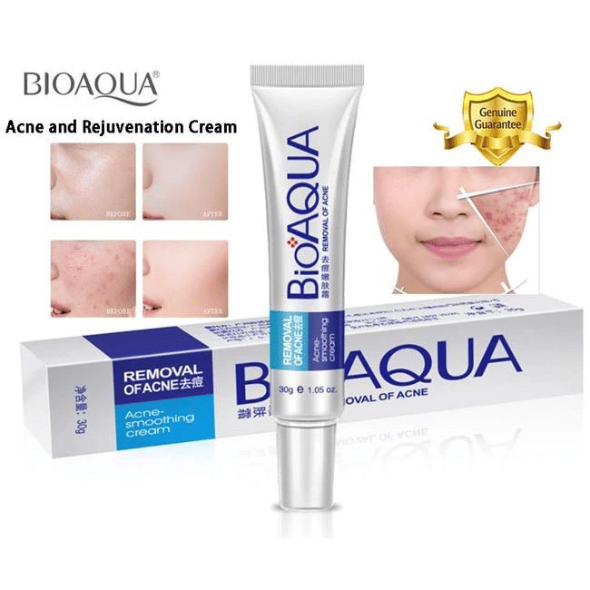 BIOAQUA Acne-Smoothing Cream Plant Extracts Oil Control Scar Lightening 30g