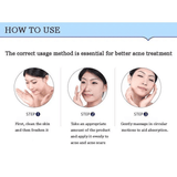 BIOAQUA Acne-Smoothing Cream Plant Extracts Oil Control Scar Lightening 30g