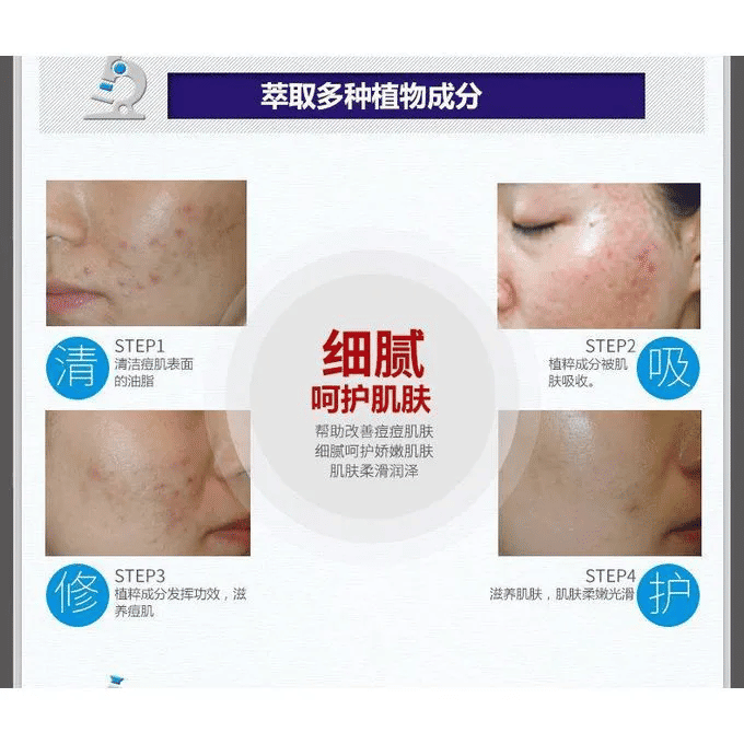 BIOAQUA Acne-Smoothing Cream 30g
