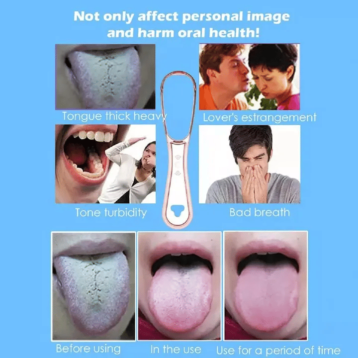 4pcs Family Pack Tongue Scrapers Cleaners Brushes 100% BPA Free For Adults & Kids