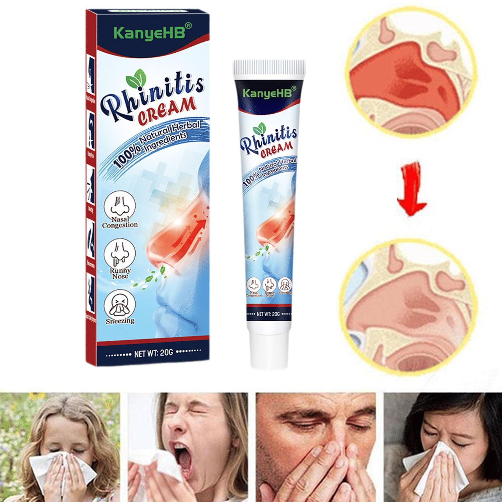 Rhinitis Nasal Cream Herbal Treatment for Sinusitis Relief 20g