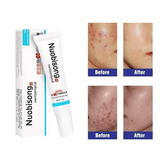 Nuobisong Skin Restoration Gel Dark Spots Stretch Marks Scars 15g